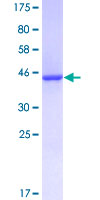 12.5% SDS-PAGE Stained with Coomassie Blue